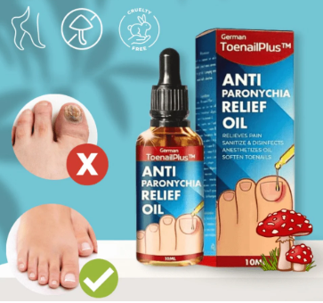 Anti Hongo ToenailPlus: Elimina Hongos de Uñas de Manera Eficaz y Rápida